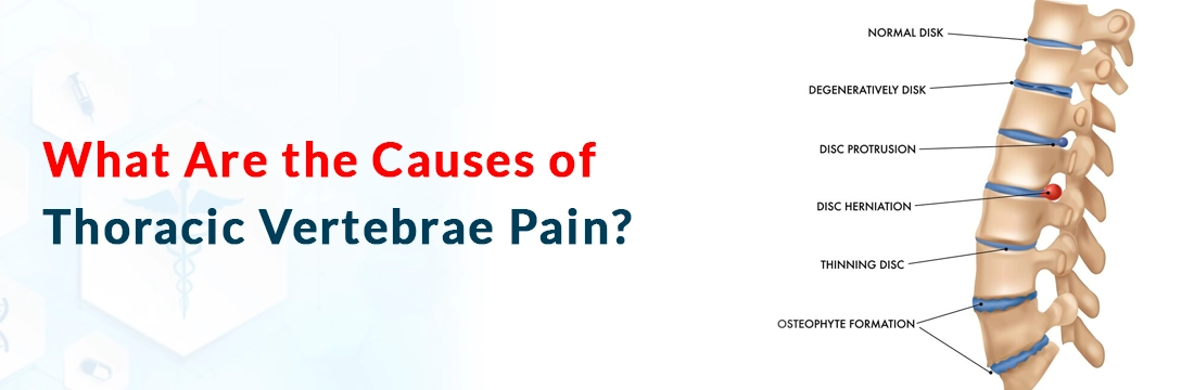What Are the Causes of Thoracic Vertebrae Pain?